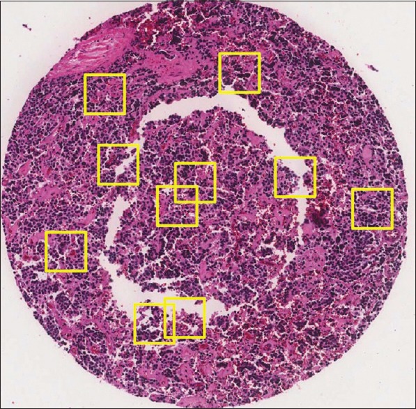 Figure 11