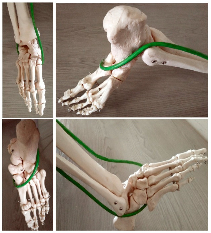 Figure 2