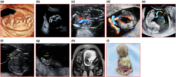 FIGURE 1