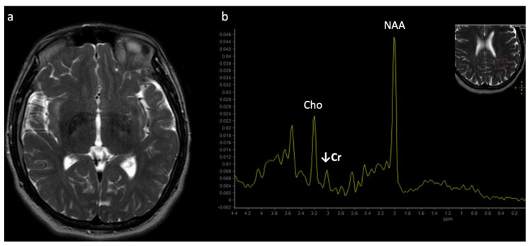 Figure 17