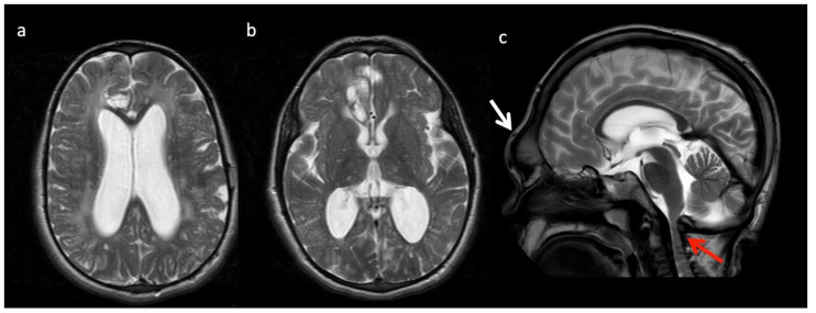 Figure 11