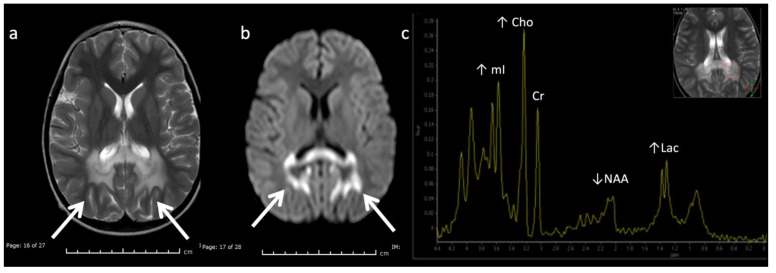 Figure 12