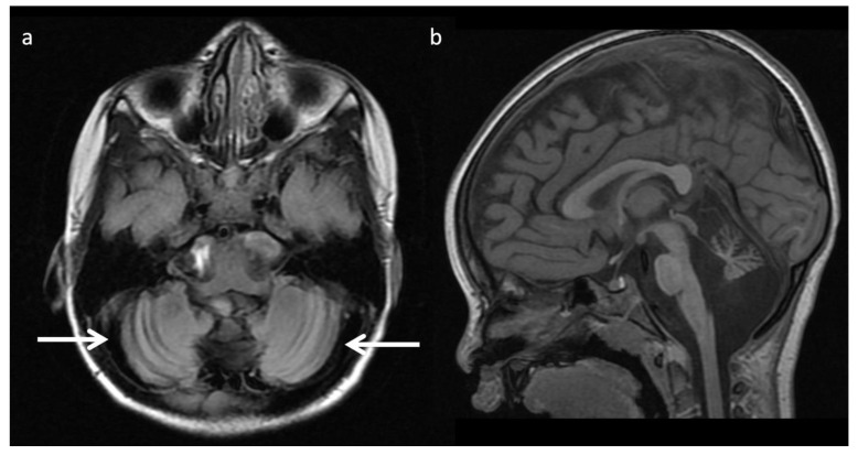 Figure 18