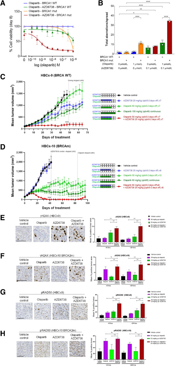 Figure 5. AZD6738 combination with the PARP inhibitor olaparib. A, AZD6738 potentiates the activity of olaparib and shows synergistic growth inhibition of BRCA1-mutant (Δ11q) UWB1.289 cells preferentially over UWB1.289+BRCA1–complemented cells. Representative growth inhibition plots are shown. B, Metaphase spreads for AZD6738 and olaparib combination shows a synergistic increase in chromosomal aberrations in UWB1.289 compared with UWB1.289+BRCA1–complemented cells. C and D, In vivo efficacy of olaparib in combination with AZD6738 in TNBC PDX models using 50 mg/kg once daily olaparib plus 25 mg/kg AZD6738 on 5 days-on/2 days-off weekly schedule (×6) in HBCx-9 BRCA WT (C) or HBCx-10 BRCA2-mutant model (D). Mean tumor volume ± SEM is shown. Olaparib and AZD6738 combination pharmacodynamics by IHC in HBCx-9 WT and HBCx-10 BRCA2-mutant models. E–H, Representative images at 6 hours post last dose (left) and quantification (% positive cells; right) for γH2AX in HBCx-9 (E) or HBCx-10 (F), and pRAD50 pSer635 in HBCx-9 (G) or HBCx-10 (H) models. Scale bars, 100 μm. *, P ≤ 0.05; **, P ≤ 0.01; ***, P ≤ 0.001; ****, P ≤ 0.0001.