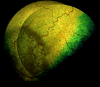Fig 9