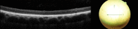 Fig 12