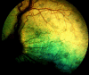 Fig 10