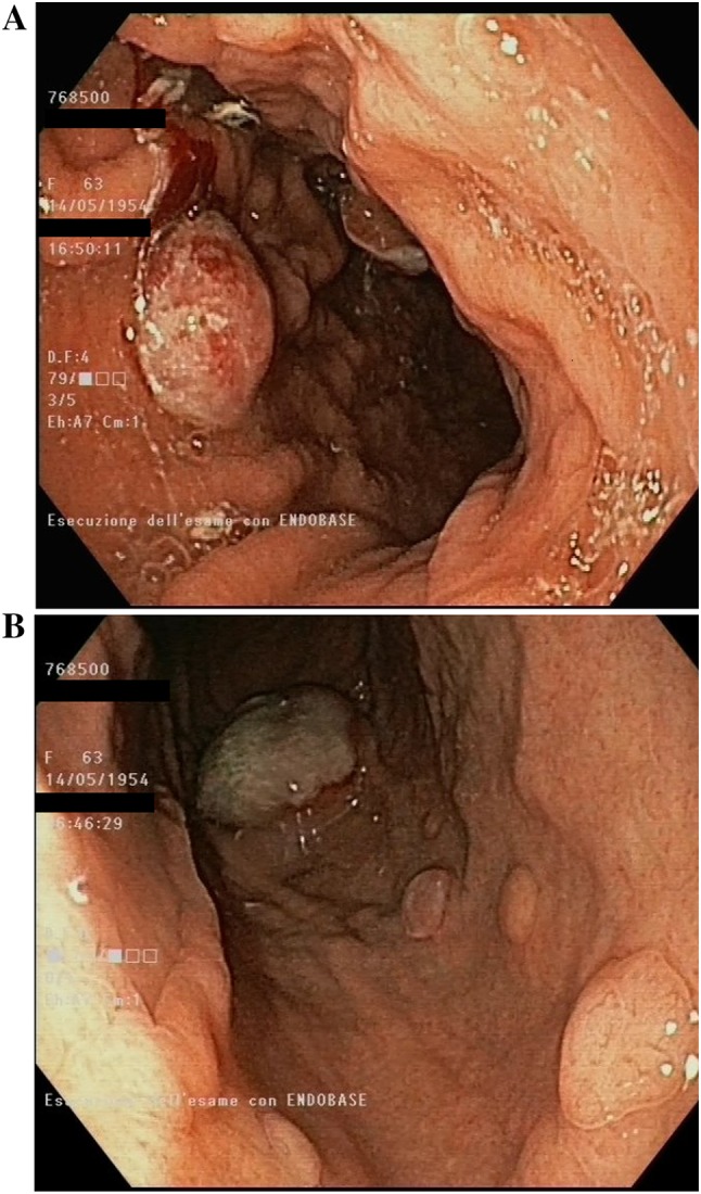 Fig.1