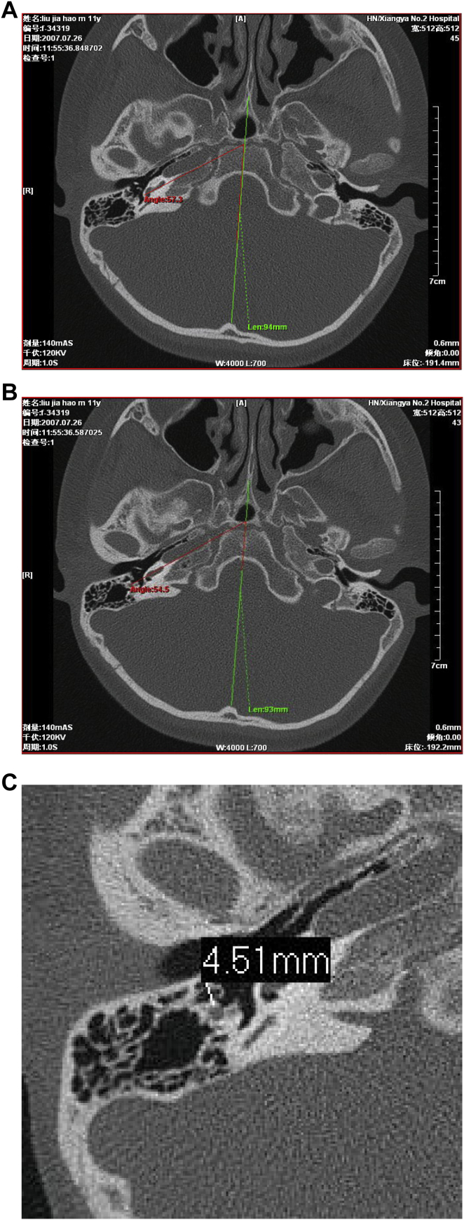 Fig. 1