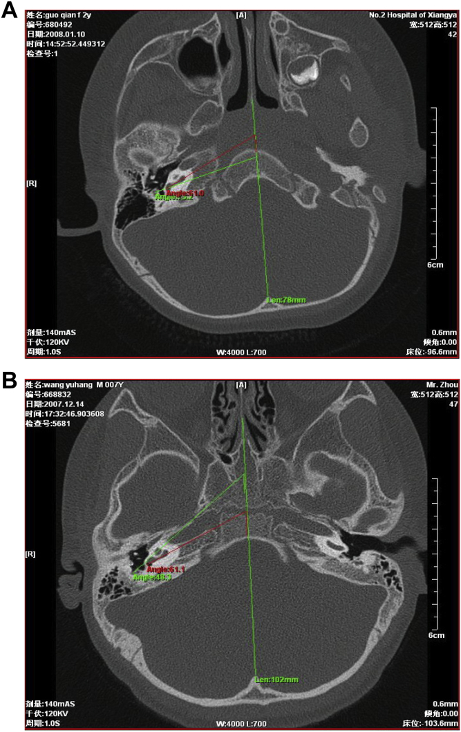 Fig. 9