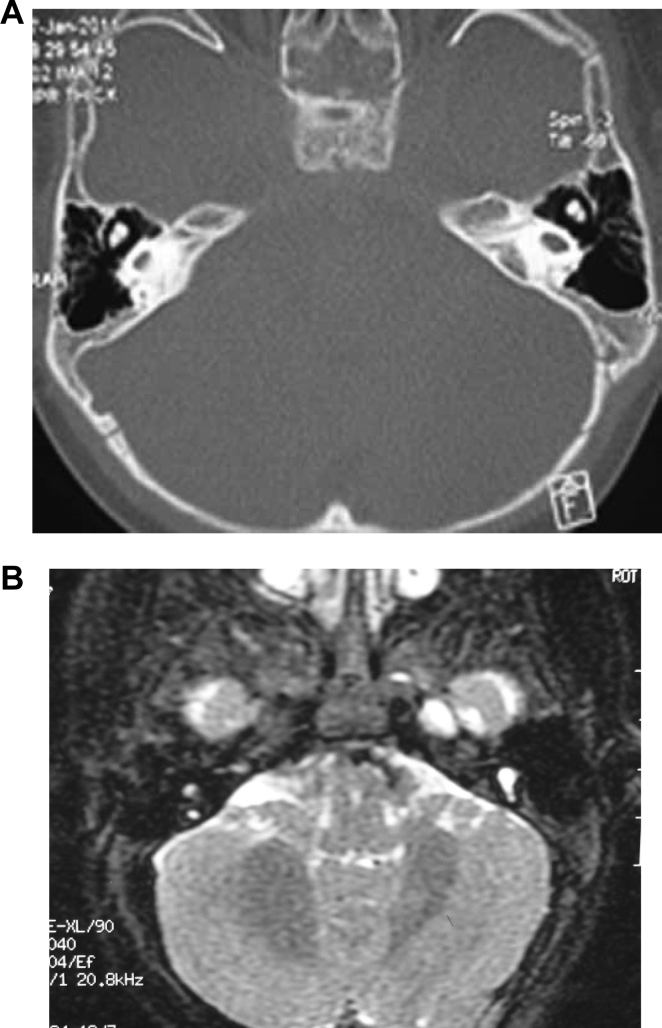 Fig. 3