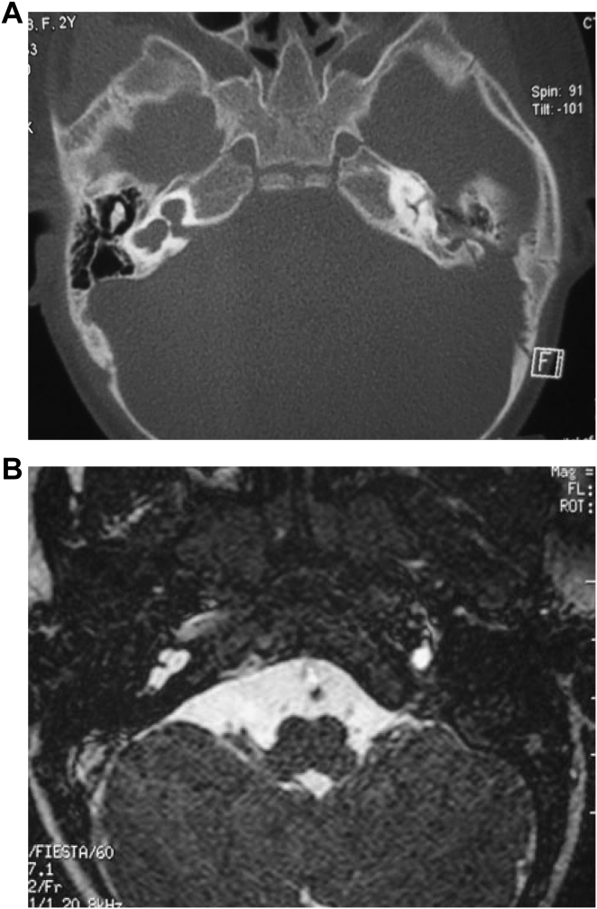 Fig. 4