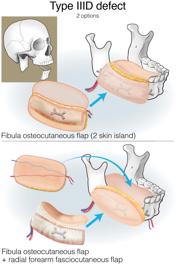 Figure 17