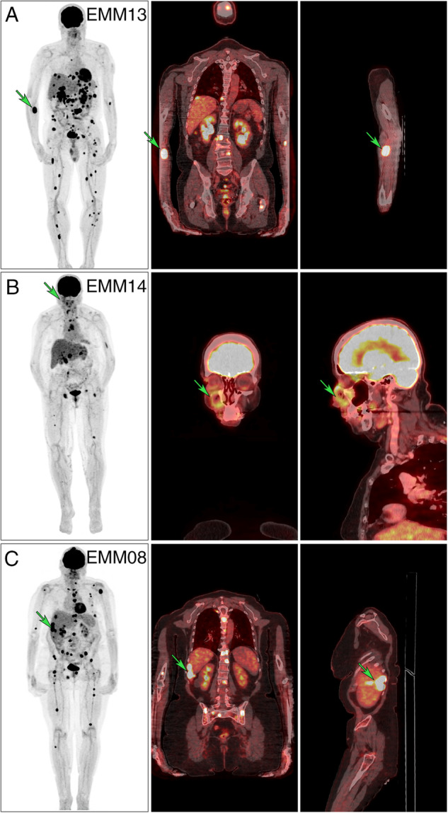 Fig. 2