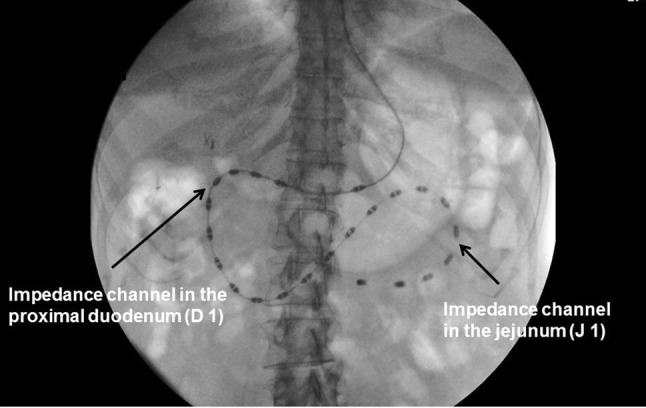 Fig. 2