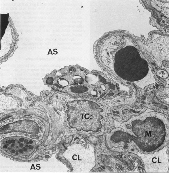 FIGURE 18.