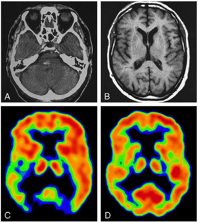 fig 1.