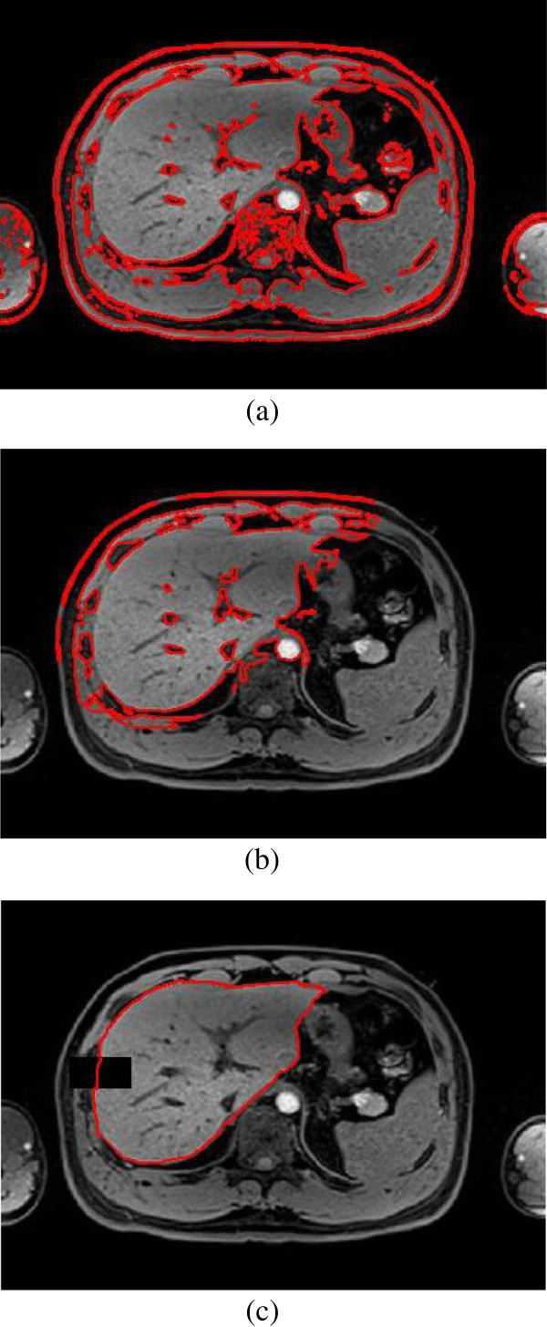 Figure 11