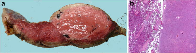 Fig. 22