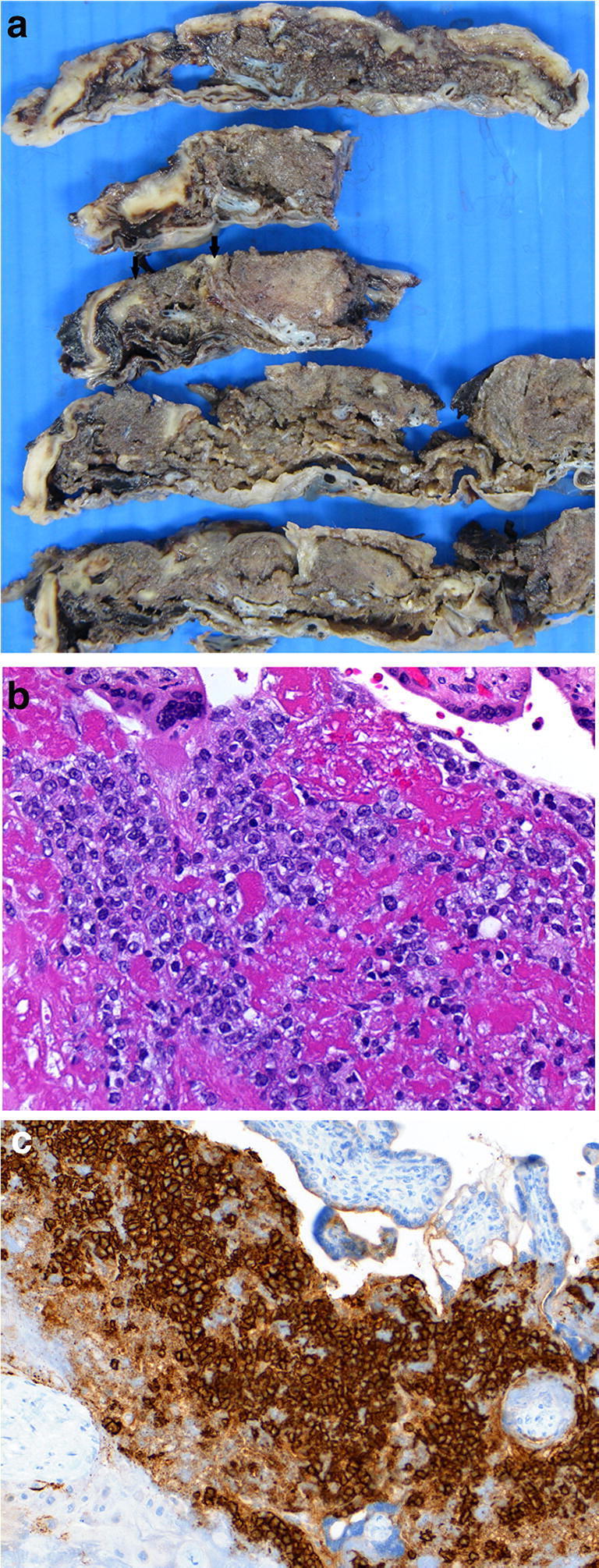 Fig. 23