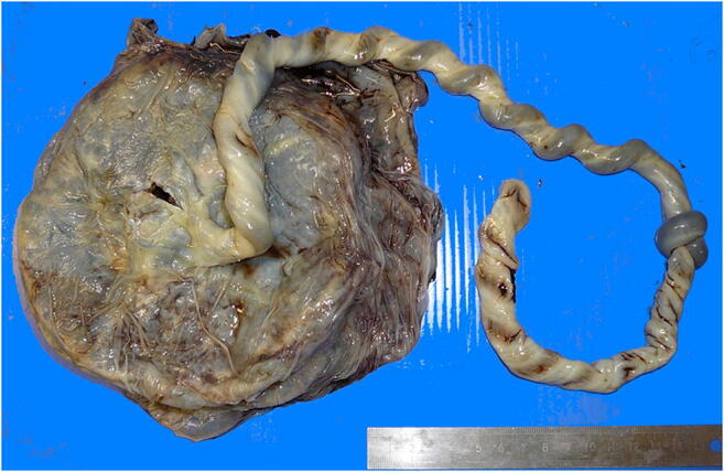 Fig. 1
