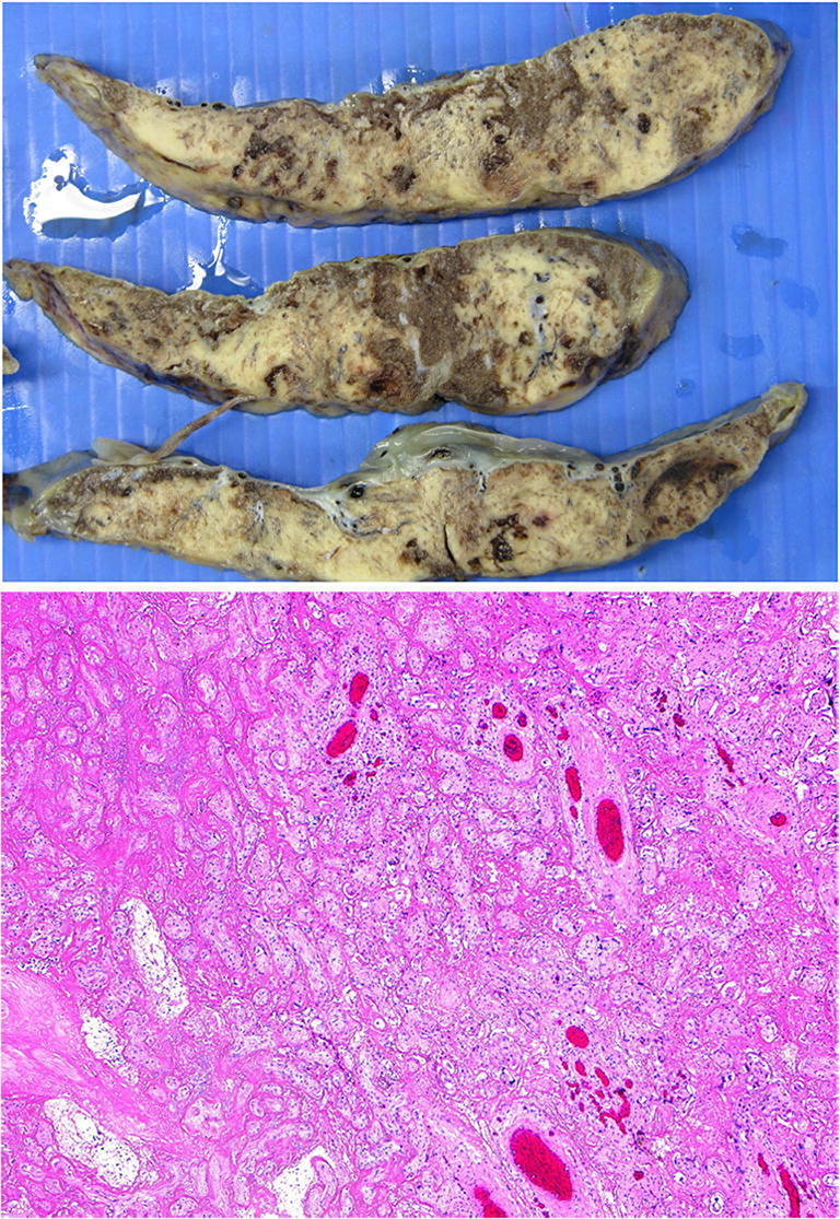 Fig. 20