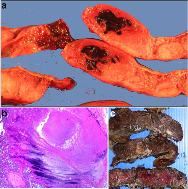 Fig. 11
