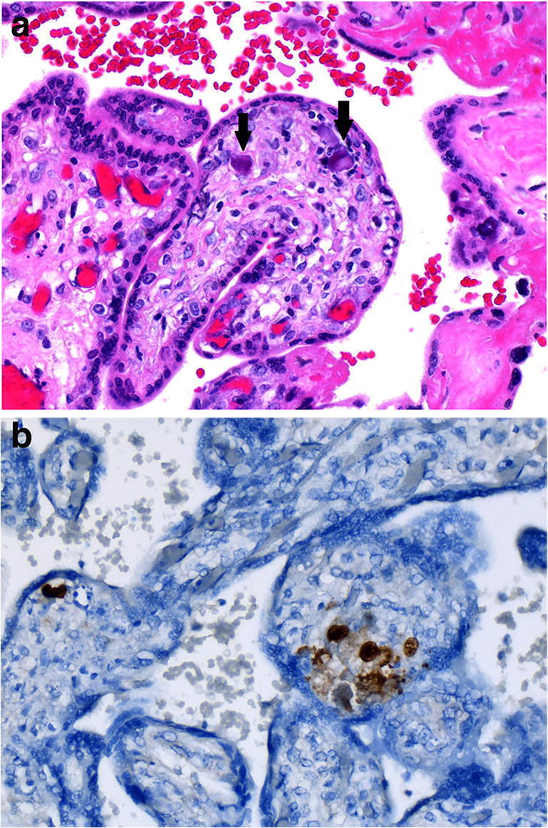 Fig. 18