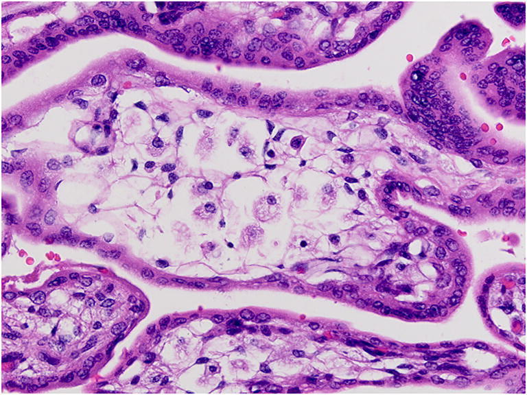 Fig. 21