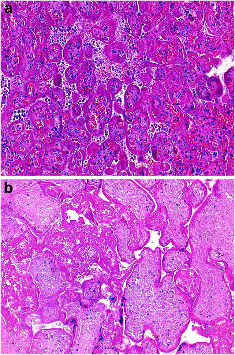 Fig. 9