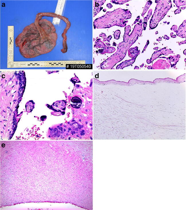 Fig. 26