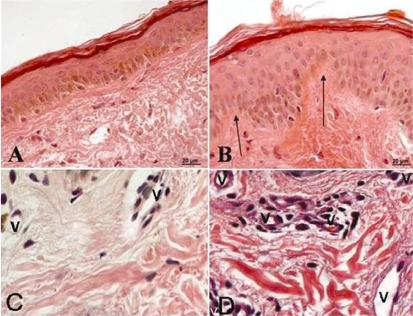 Figure 1 -