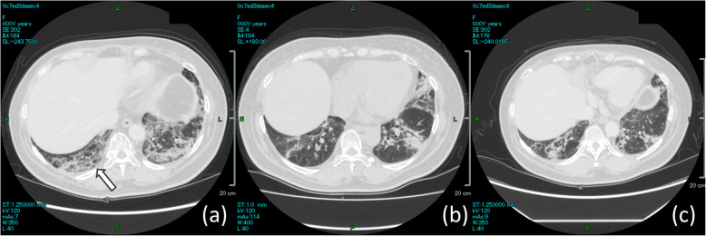 Fig. 3