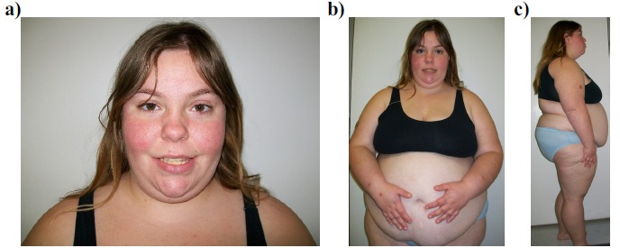 Fig. (2)