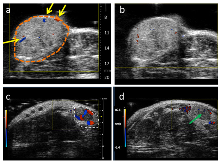 Figure 11