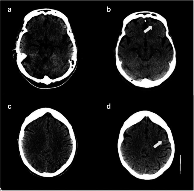 Fig. 2