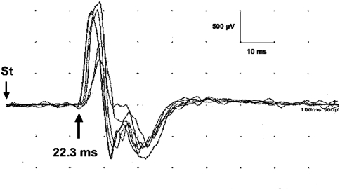 Fig. 2