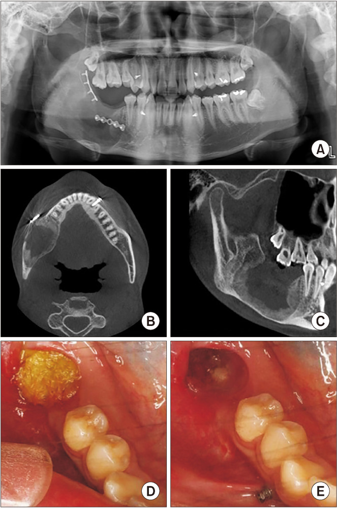 Fig. 9