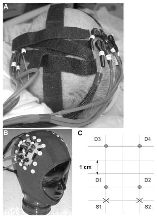 Fig. 1