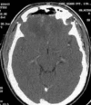 Figure 2c