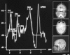 Figure 3d