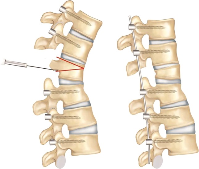 Fig. 3