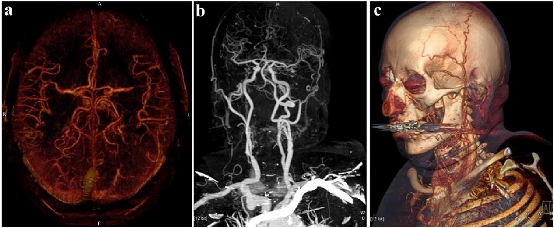 Fig. 6.