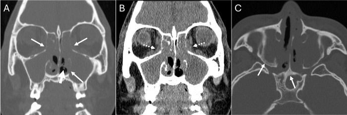 Fig 5