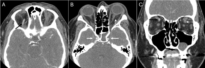 Fig 1