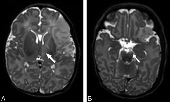 Fig 6.