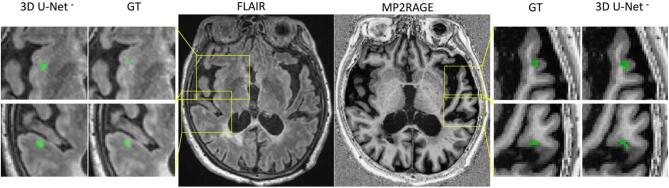 Fig. 6