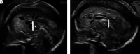FIG 4.