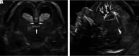 FIG 1.