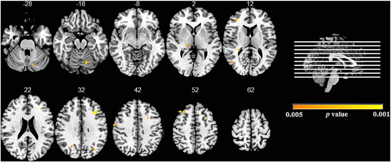 Fig. 2